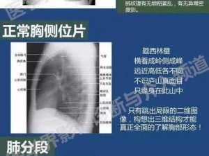 女性胸部健康不容忽视，全新女生胸片曝光，守护你的美丽与健康